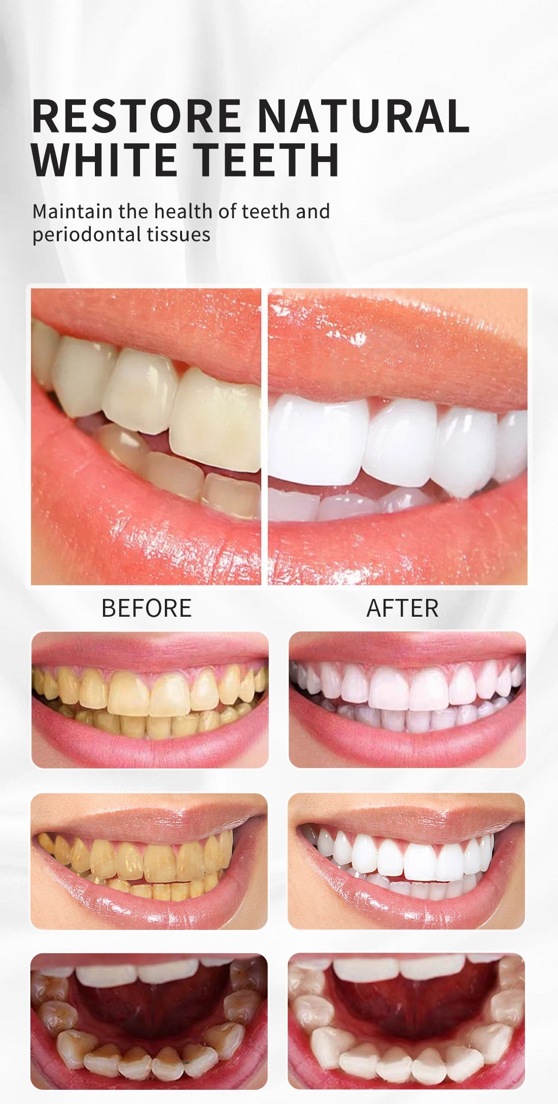 Brill Smiles™- Teeth Whitening Foam