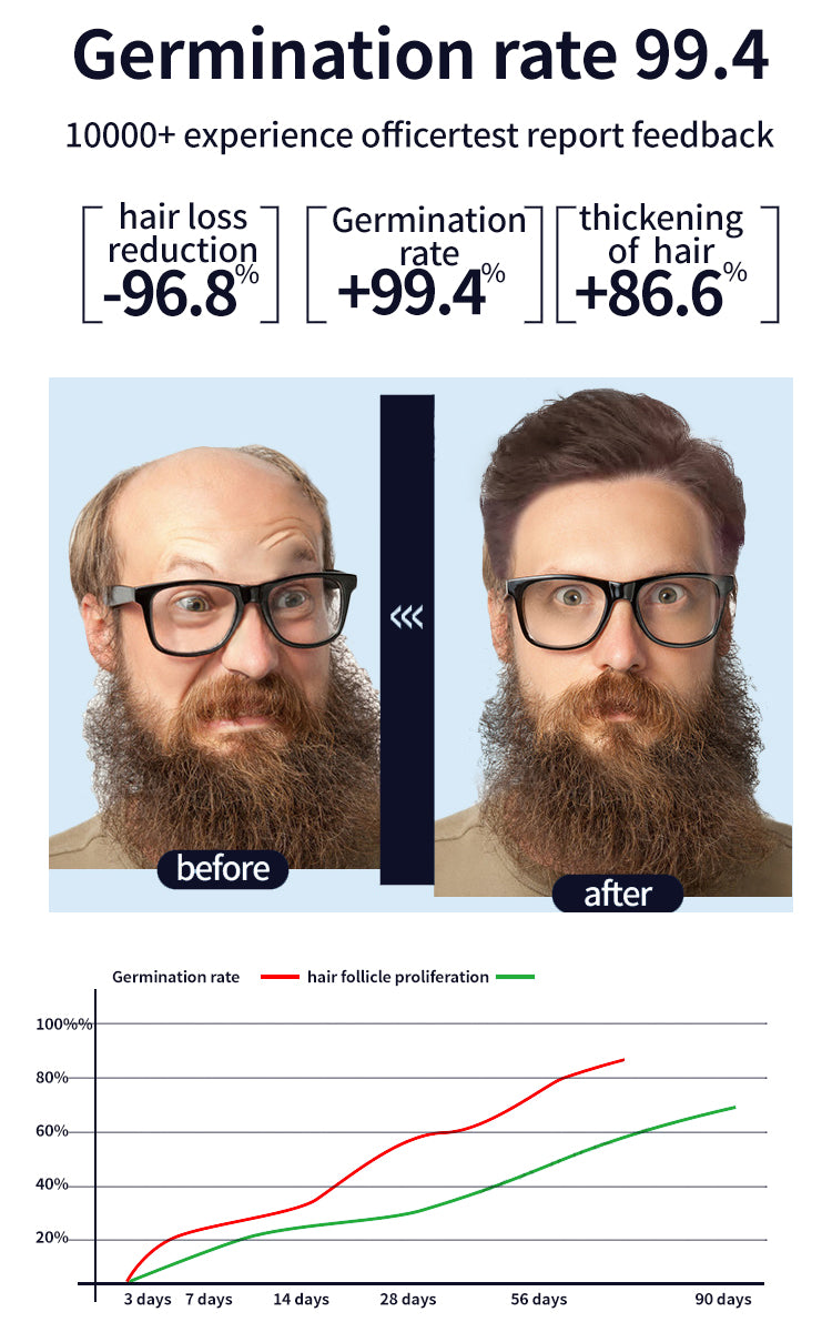 Super Growth- Anti-Hair Loss Oil