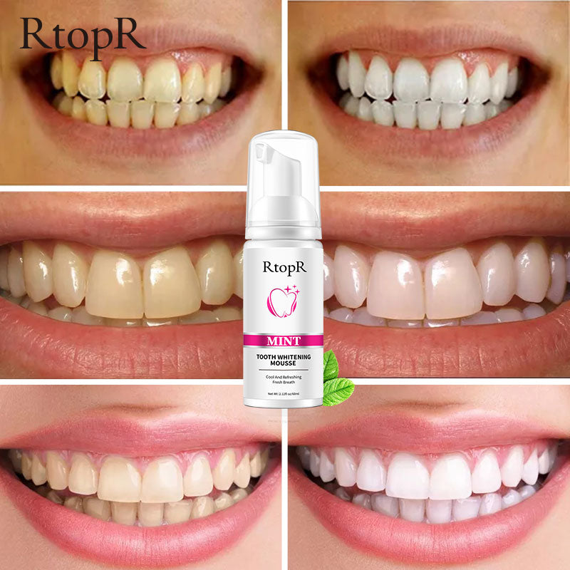 Brill Smiles™- Teeth Whitening Foam