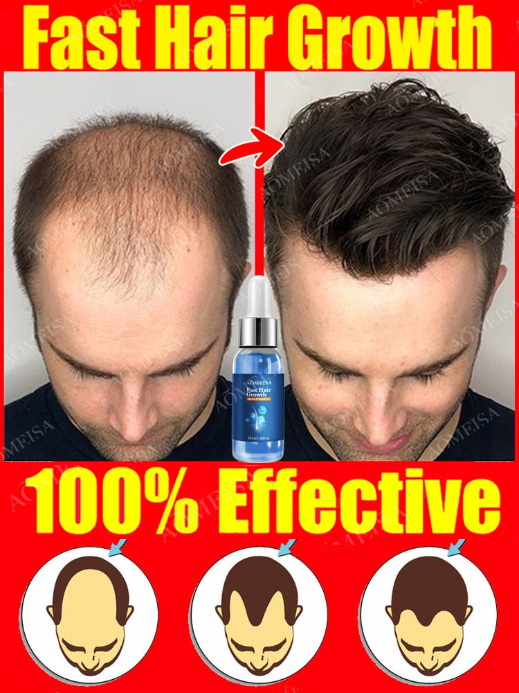Super Growth- Anti-Hair Loss Oil