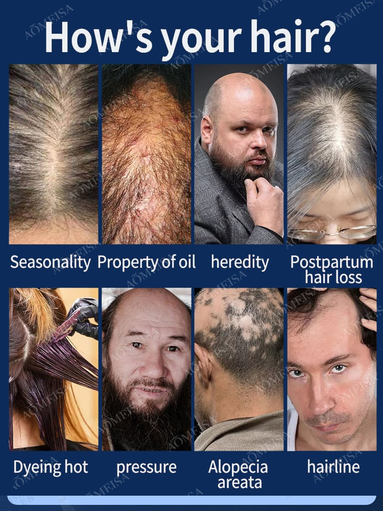 Super Growth- Anti-Hair Loss Oil