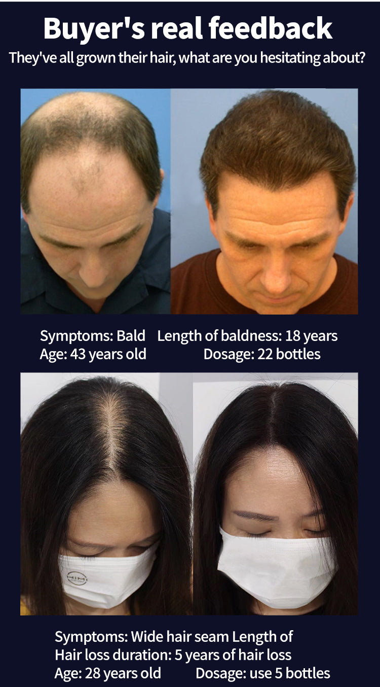 Super Growth- Anti-Hair Loss Oil
