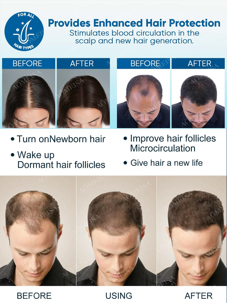 Super Growth- Anti-Hair Loss Oil