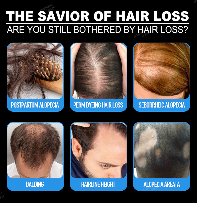 Super Growth- Anti-Hair Loss Oil