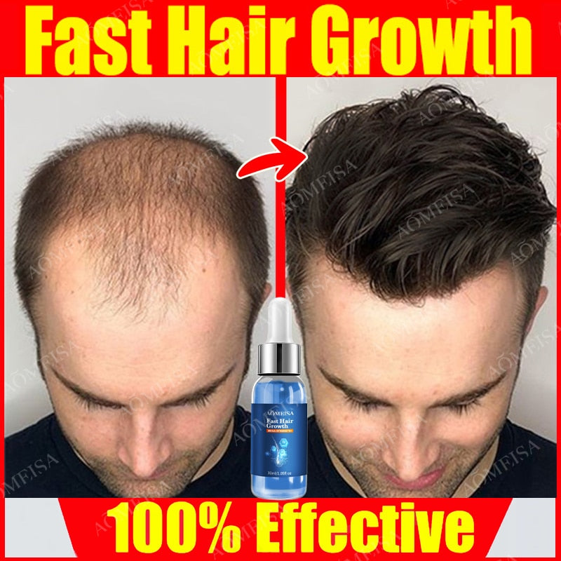 Super Growth- Anti-Hair Loss Oil