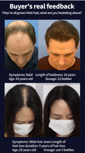 Load image into Gallery viewer, Super Growth-  Anti-Hair Loss Oil
