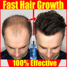 Load image into Gallery viewer, Super Growth-  Anti-Hair Loss Oil
